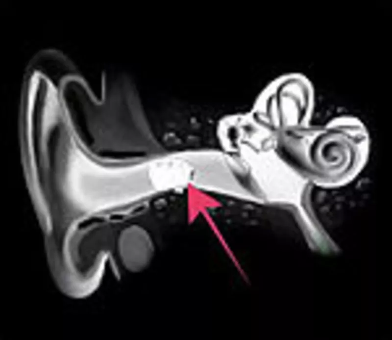 Микронаушник 4