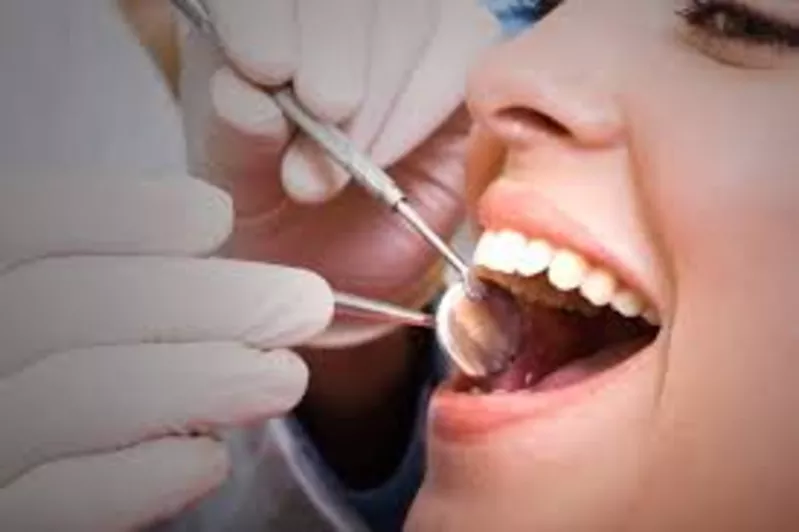лечение кариеса ,  пломбирование зуба ,  протезирования зубов 3