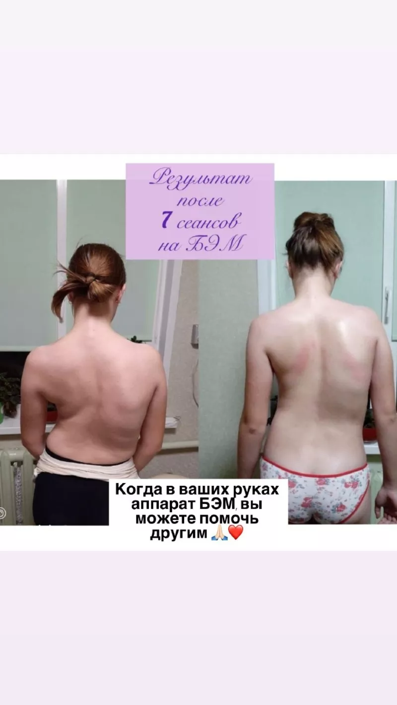 ОРГАНЫ ПОД ЗАЩИТОЙ БИОЭНЕРГИИ. 5