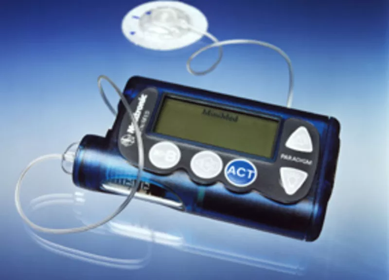 Инсулиновая помпа